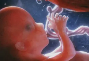 Reformokkal tenné elérhetőbbé az abortuszt Izrael