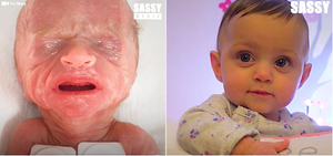 Minden nap megküzdött az életéért a kicsi hős - a 14 héttel korábban született Tru története