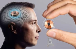 Beültették az első ember agyába Elon Musk chipjét